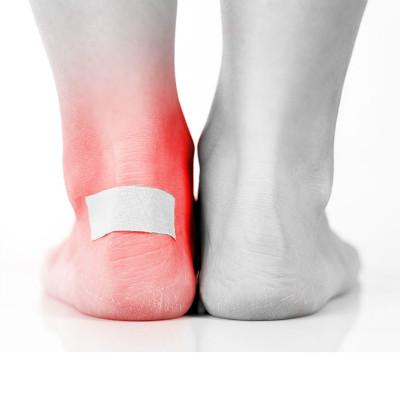What symptom does allergic dermatitis symptom have