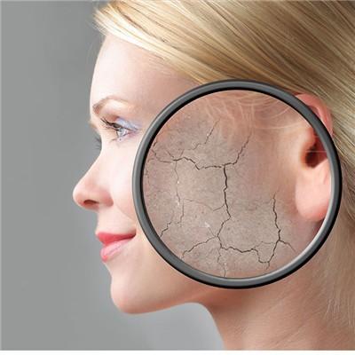 Traditional Chinese medicine can regulate nevus fuscocerus