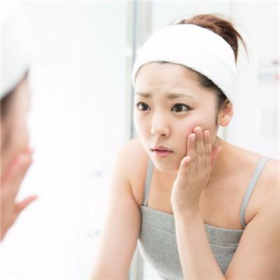 Methods of clearing acne