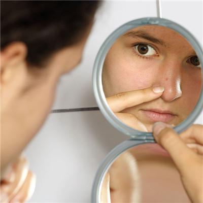 How does acne grow on the face do