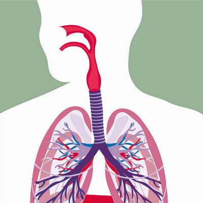 Symptoms of pulmonary edema?
