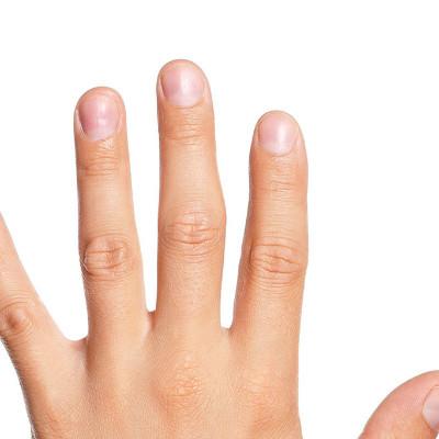 What is the reason that finger does not have crescent