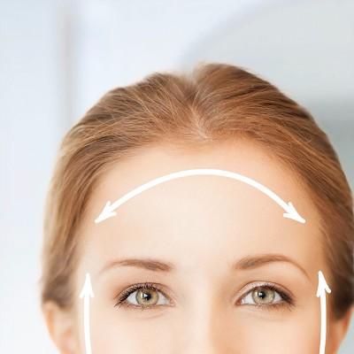 What are the precautions before embedding double eyelids