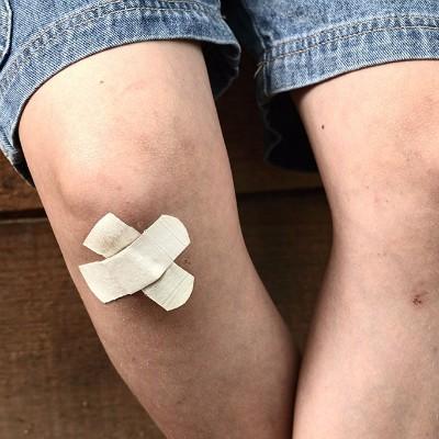 How to treat psoriasis
