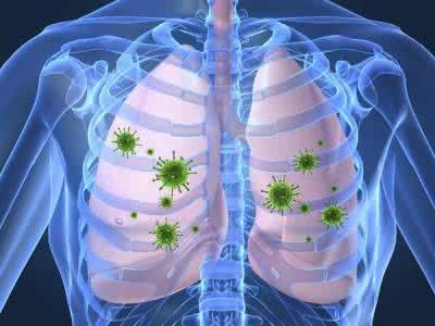 Is right back hemp lung cancer inchoate symptom?